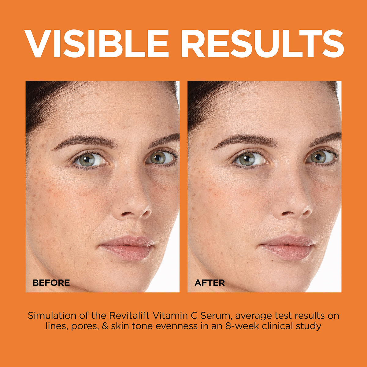Vitamin C Brightening Face Serum with Vitamin E, Salicylic Acid, 1 oz B489500